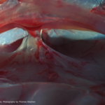 Introductie myofasciale therapie